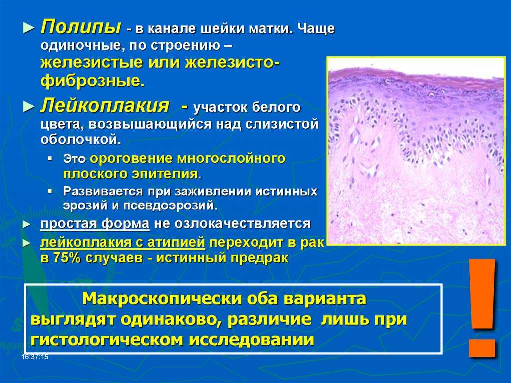 Кольпоскопия сосудистый рисунок усиленный